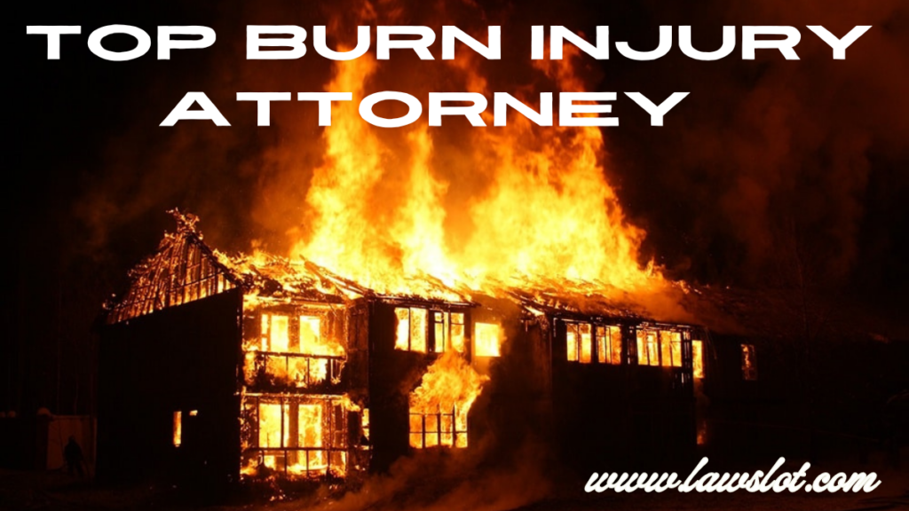 Top Burn Injury Attorney